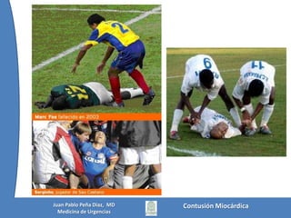 Contusión MiocárdicaJuan Pablo Peña Diaz,  MDMedicina de Urgencias