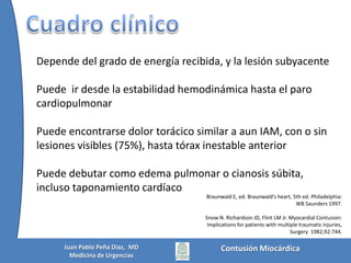 > 35 Km/hContusión MiocárdicaJuan Pablo Peña Diaz,  MDMedicina de Urgencias