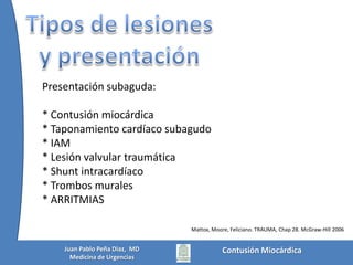Contusión MiocárdicaJuan Pablo Peña Diaz,  MDMedicina de Urgencias