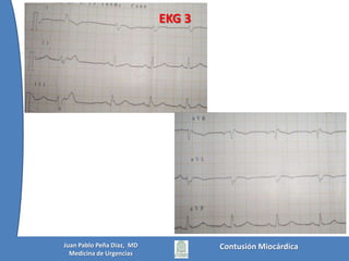  Transitoria  (< 36 h) y significativa (TcIn > 2)