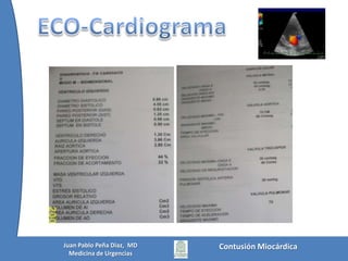 BiomarcadoresEdouard:  Conclusiones Puede haber manifestaciones cardiacas incluso con troponinas normales