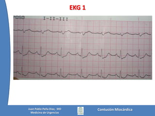  TRM alto con Shock neurogénico
