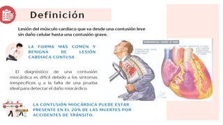 Definición
LA CONTUSIÓN MIOCÁRDICA PUEDE ESTAR
PRESENTE EN EL 20% DE LAS MUERTES POR
ACCIDENTES DE TRÁNSITO.
Lesión del músculo cardíaco que va desde una contusión leve
sin daño celular hasta una contusión grave.
LA FORMA MÁS COMÚN Y
BENIGNA DE LESIÓN
CARDIACA CONTUSA
El diagnóstico de una contusión
miocárdica es difícil debido a los síntomas
inespecíficos y a la falta de una prueba
ideal para detectar el daño miocárdico.
 
