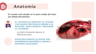 Anatomía
HISTOLÓGICAMENTE SE DEFINE POR
HEMORRAGIA MIOCÁRDICA, EDEMA Y
NECROSIS LOCALIZADA
El corazón está situado en la parte media del tórax
por debajo del esternón.
EL VENTRÍCULO DERECHO SE LESIONA
CON MAYOR FRECUENCIA DEBIDO A SU
POSICIÓN DIRECTAMENTE POSTERIOR
AL ESTERNÓN
La lesión bicameral alcanza el
50% de los casos
 