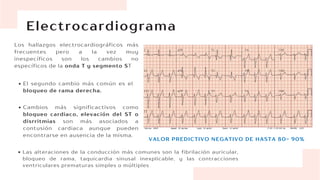 Electrocardiograma
Los hallazgos electrocardiográficos más
frecuentes pero a la vez muy
inespecíficos son los cambios no
específicos de la onda T y segmento ST
VALOR PREDICTIVO NEGATIVO DE HASTA 80- 90%
El segundo cambio más común es el
bloqueo de rama derecha.
Cambios más significactivos como
bloqueo cardiaco, elevación del ST o
disrritmias son más asociados a
contusión cardiaca aunque pueden
encontrarse en ausencia de la misma.
Las alteraciones de la conducción más comunes son la fibrilación auricular,
bloqueo de rama, taquicardia sinusal inexplicable, y las contracciones
ventriculares prematuras simples o múltiples
 