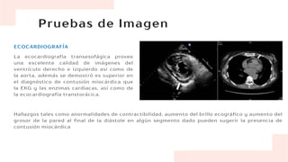 Pruebas de Imagen
La ecocardiografía transesofágica provee
una excelente calidad de imágenes del
ventrículo derecho e izquierdo así como de
la aorta, además se demostró es superior en
el diagnóstico de contusión miocárdica que
la EKG y las enzimas cardiacas, así como de
la ecocardiografía transtorácica.
ECOCARDIOGRAFÍA
Hallazgos tales como anormalidades de contractibilidad, aumento del brillo ecográfico y aumento del
grosor de la pared al final de la diástole en algún segmento dado pueden sugerir la presencia de
contusión miocárdica
 