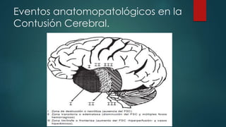 Eventos anatomopatológicos en la
Contusión Cerebral.
 