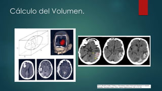 Cálculo del Volumen.
 