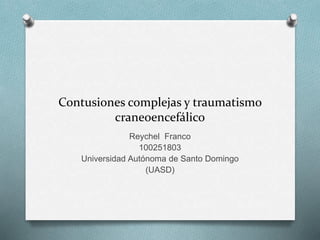 Contusiones complejas y traumatismo
craneoencefálico
Reychel Franco
100251803
Universidad Autónoma de Santo Domingo
(UASD)
 