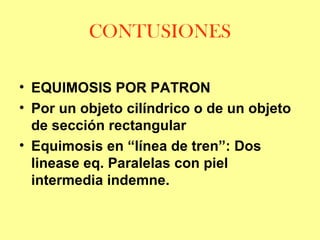 CONTUSIONES
• EQUIMOSIS POR PATRON
• Por un objeto cilíndrico o de un objeto
de sección rectangular
• Equimosis en “línea de tren”: Dos
linease eq. Paralelas con piel
intermedia indemne.

 