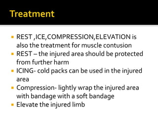  REST ,ICE,COMPRESSION,ELEVATION is
also the treatment for muscle contusion
 REST – the injured area should be protected
from further harm
 ICING- cold packs can be used in the injured
area
 Compression- lightly wrap the injured area
with bandage with a soft bandage
 Elevate the injured limb
 