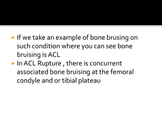  If we take an example of bone brusing on
such condition where you can see bone
bruising is ACL
 In ACL Rupture , there is concurrent
associated bone bruising at the femoral
condyle and or tibial plateau
 