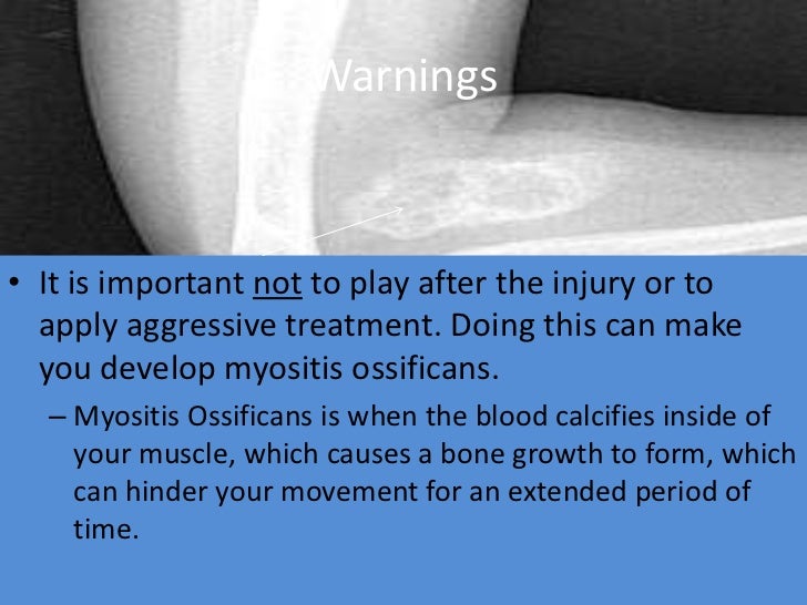 Contusions & abrasions