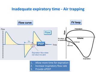 Inadequate expiratory time - Air trapping
iPEEP
Flow curve FV loop
1. Allow more time for expiration
2. Increase inspiratory flow rate
3. Provide ePEEP
 