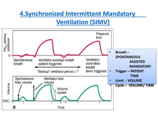 4.Synchronized Intermittent Mandatory
Ventilation (SIMV)
• Breath –
SPONTANEOUS
ASSISTED
MANDATORY
• Trigger – PATIENT
TIME
• Limit - VOLUME
• Cycle – VOLUME/ TIME
 