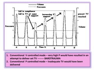 1. Conventional V controlled mode – very high P would have resulted in an
attempt to deliver set TV -------- BAROTRAUMA
2. Conventional P controlled mode – inadequate TV would have been
delivered
 