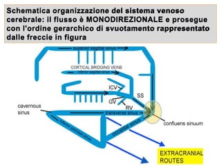 Schematica organizzazione del sistema venoso
cerebrale: il flusso è MONODIREZIONALE e prosegue
con l'ordine gerarchico di svuotamento rappresentato
dalle freccie in figura
 