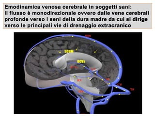 Emodinamica venosa cerebrale in soggetti sani:
il flusso è monodirezionale ovvero dalle vene cerebrali
profonde verso i seni della dura madre da cui si dirige
verso le principali vie di drenaggio extracranico
 