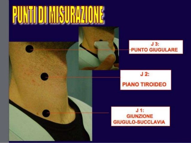 Classificazione di vene varicose su mkb
