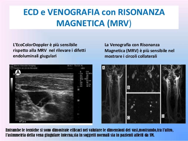 Gravidanza e trombosi di vena di una retina