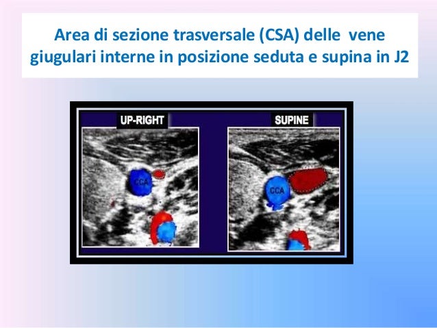 Posizione di vene e nuoto nella piscina