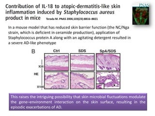 Terada M. PNAS 2006;103(23):8816–8821
This raises the intriguing possibility that skin microbial fluctuations modulate
the gene–environment interaction on the skin surface, resulting in the
episodic exacerbations of AD.
In a mouse model that has reduced skin barrier function (the NC/Nga
strain, which is deficient in ceramide production), application of
Staphylococcus protein A along with an agitating detergent resulted in
a severe AD-like phenotype
 