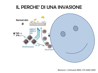 AD skin
Nomura I. J Immunol 2003; 171:3262-3269
S. Aureus
IL PERCHE’ DI UNA INVASIONE
Normal skin
 