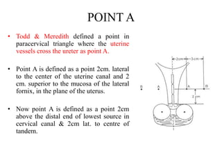 POINT A
• Todd & Meredith defined a point in
paracervical triangle where the uterine
vessels cross the ureter as point A.
• Point A is defined as a point 2cm. lateral
to the center of the uterine canal and 2
cm. superior to the mucosa of the lateral
fornix, in the plane of the uterus.
• Now point A is defined as a point 2cm
above the distal end of lowest source in
cervical canal & 2cm lat. to centre of
tandem.
 