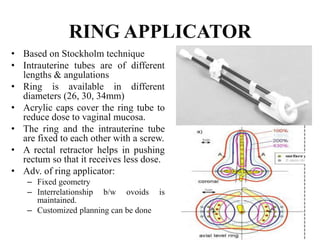RING APPLICATOR
• Based on Stockholm technique
• Intrauterine tubes are of different
lengths & angulations
• Ring is available in different
diameters (26, 30, 34mm)
• Acrylic caps cover the ring tube to
reduce dose to vaginal mucosa.
• The ring and the intrauterine tube
are fixed to each other with a screw.
• A rectal retractor helps in pushing
rectum so that it receives less dose.
• Adv. of ring applicator:
– Fixed geometry
– Interrelationship b/w ovoids is
maintained.
– Customized planning can be done
 