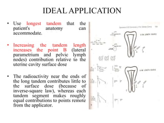IDEAL APPLICATION
• Use longest tandem that the
patient's anatomy can
accommodate.
• Increasing the tandem length
increases the point B (lateral
parametrium and pelvic lymph
nodes) contribution relative to the
uterine cavity surface dose
• The radioactivity near the ends of
the long tandem contributes little to
the surface dose (because of
inverse-square law), whereas each
tandem segment makes roughly
equal contributions to points remote
from the applicator.
 