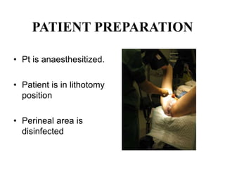 PATIENT PREPARATION
• Pt is anaesthesitized.
• Patient is in lithotomy
position
• Perineal area is
disinfected
 