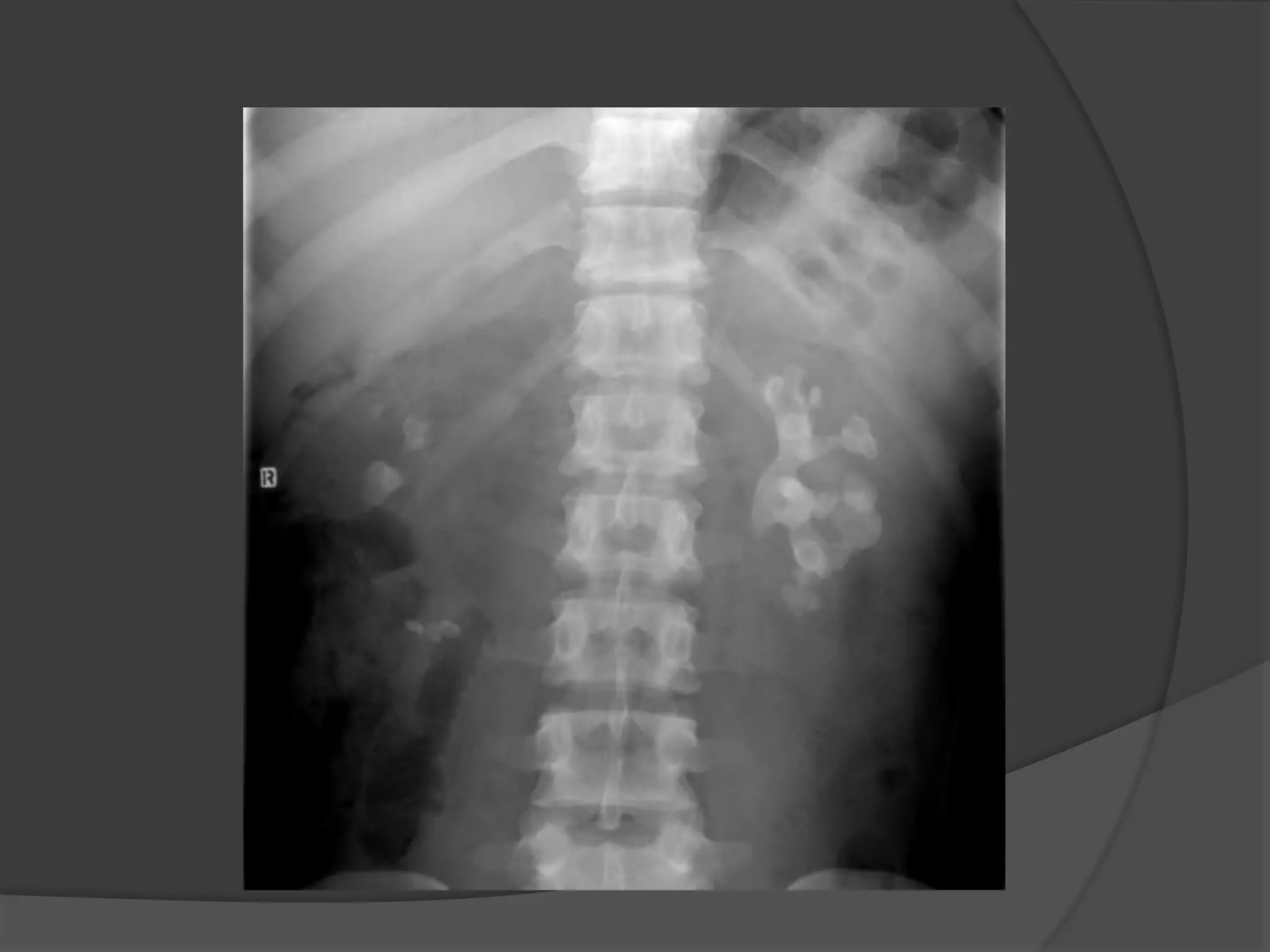 Conventional imaging of ut by dr.abd alla shady md | PPTX
