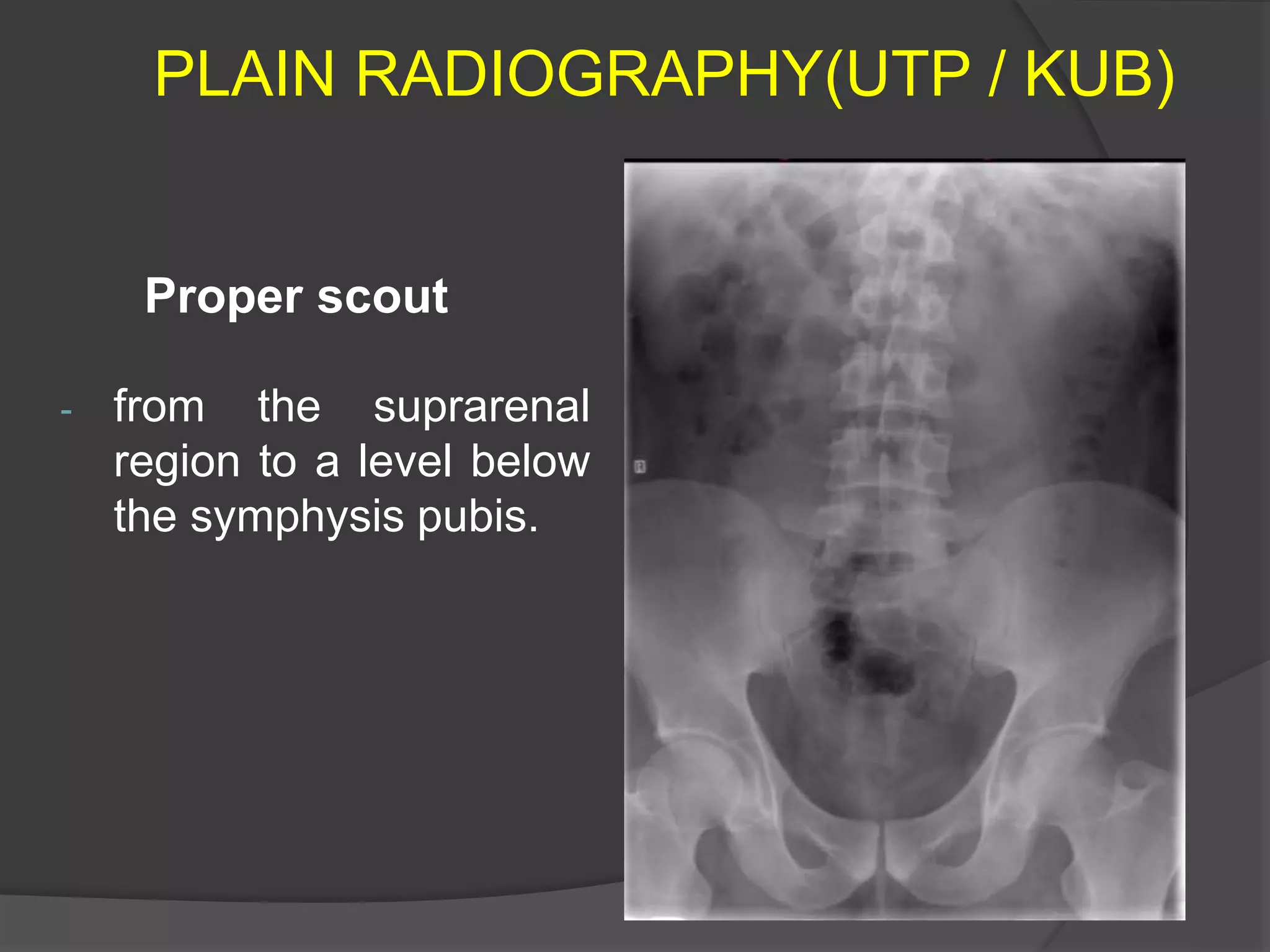 Conventional imaging of ut by dr.abd alla shady md | PPTX
