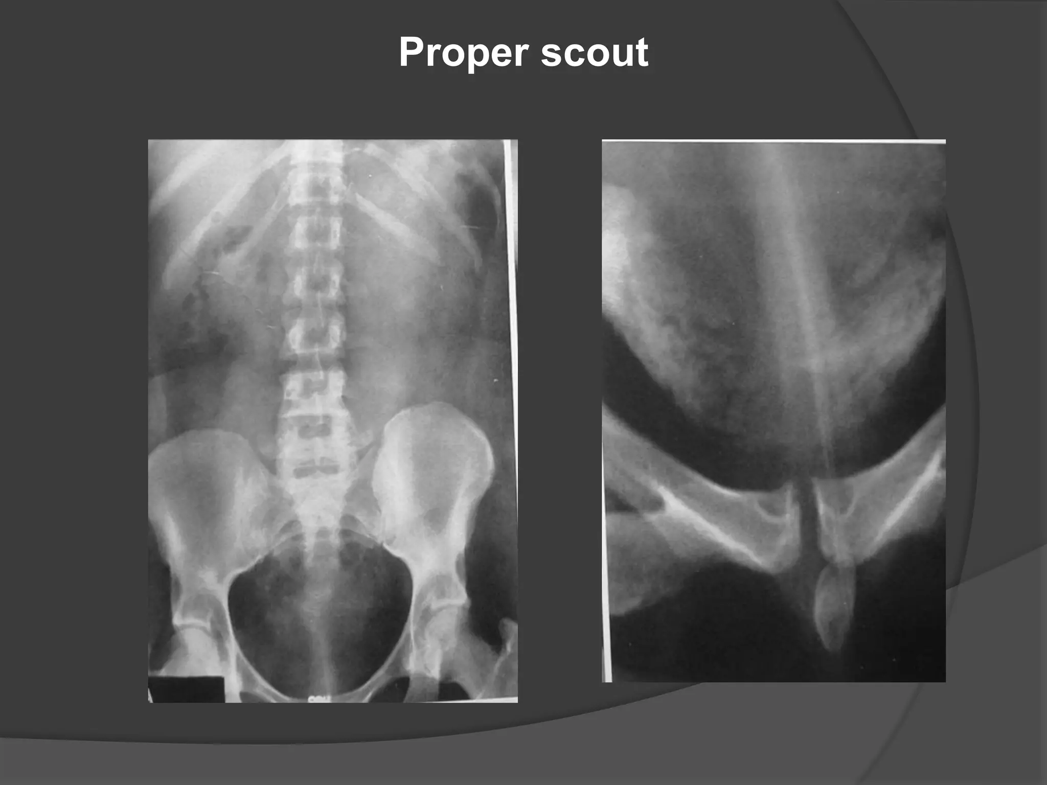 Conventional imaging of ut by dr.abd alla shady md | PPTX