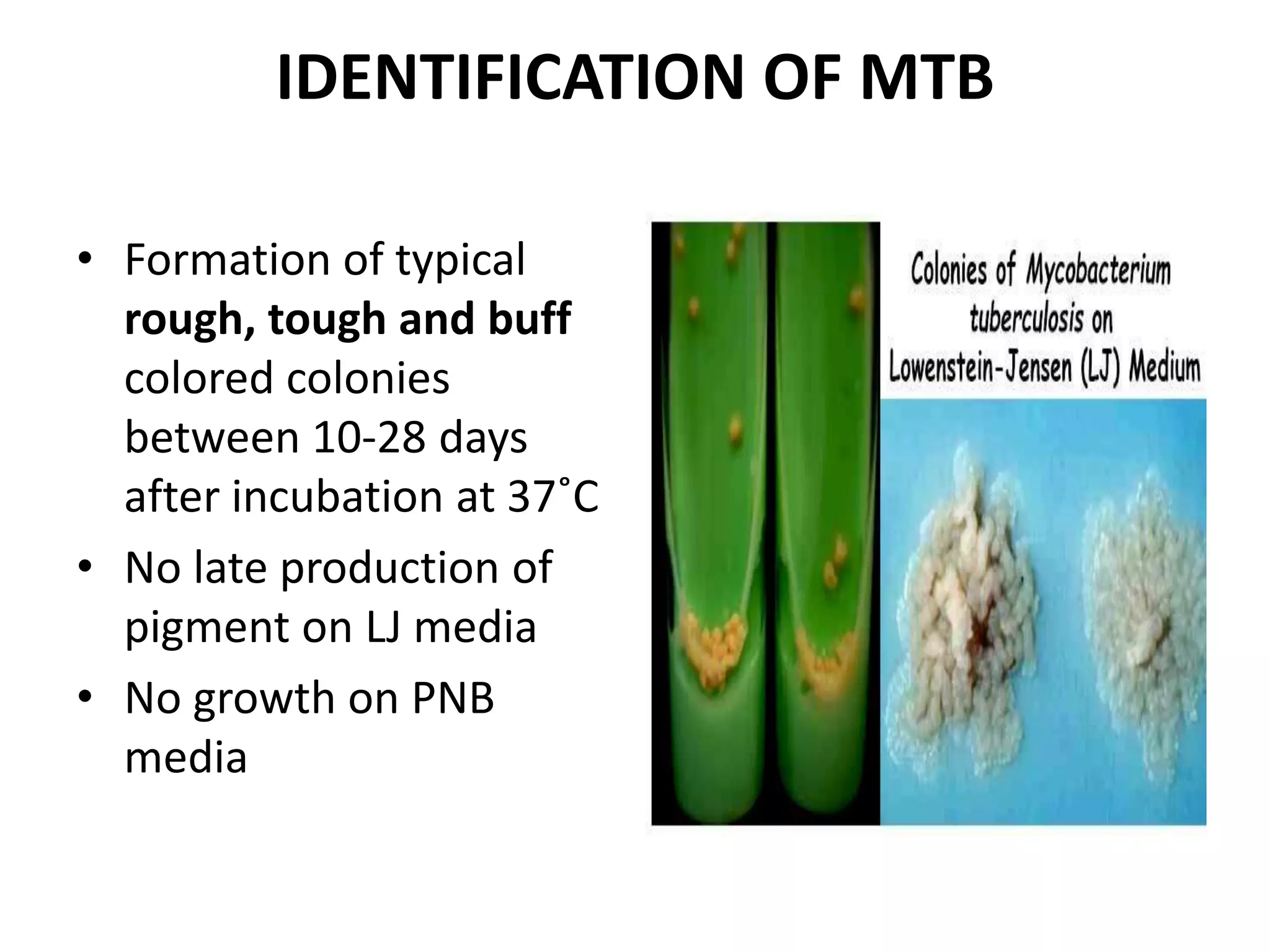 Conventional lab diagnosis of tb | PPTX