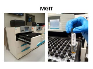 Tb Testing Simulation Lab Conventional lab diagnosis of tb | PPTX