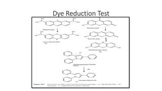 Dye Reduction Test
 