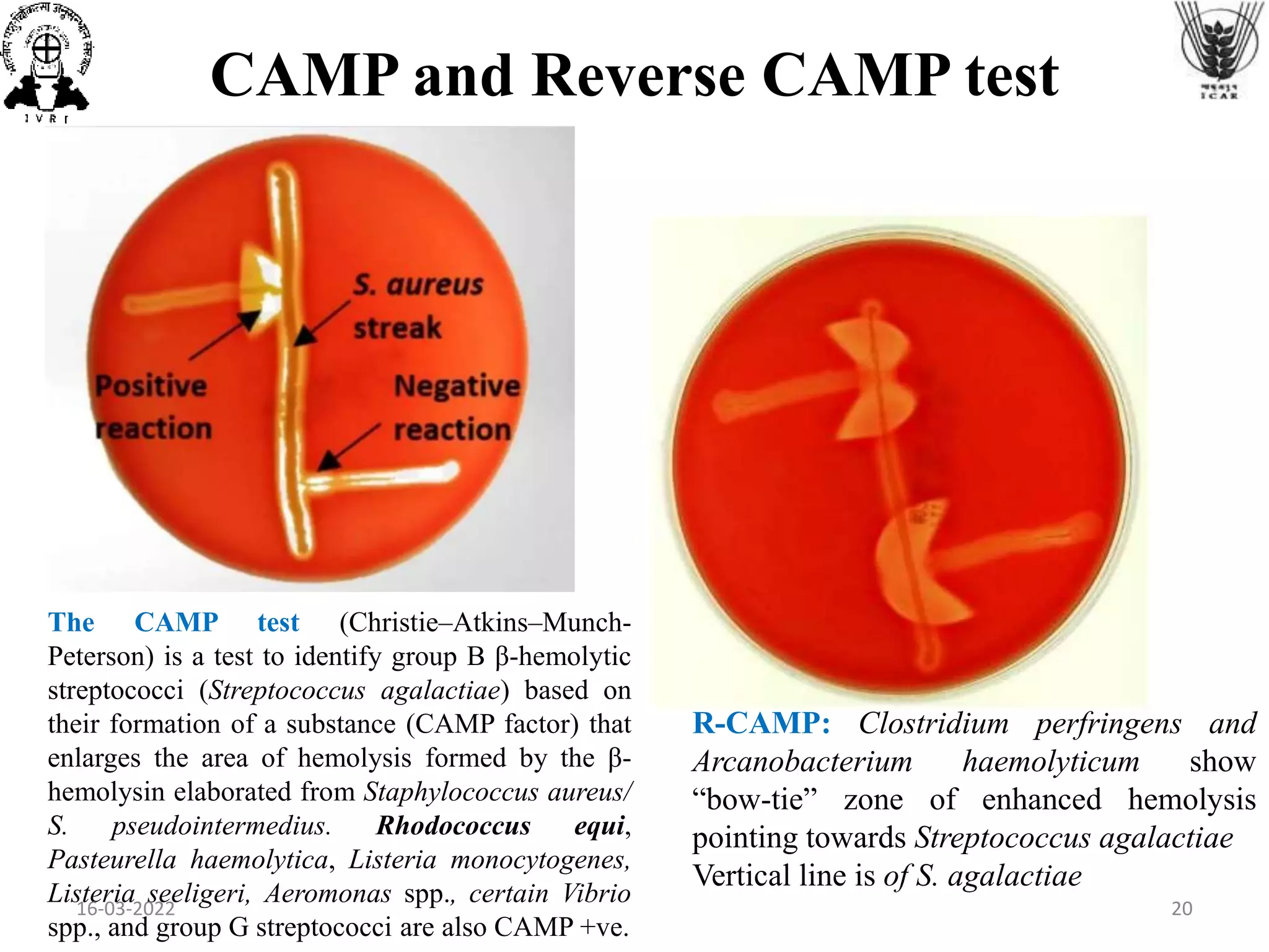 CAMP and Reverse CAMP test
R-CAMP: Clostridium perfringens and
Arcanobacterium haemolyticum show
“bow-tie” zone of enhanced hemolysis
pointing towards Streptococcus agalactiae
Vertical line is of S. agalactiae
The CAMP test (Christie–Atkins–Munch-
Peterson) is a test to identify group B β-hemolytic
streptococci (Streptococcus agalactiae) based on
their formation of a substance (CAMP factor) that
enlarges the area of hemolysis formed by the β-
hemolysin elaborated from Staphylococcus aureus/
S. pseudointermedius. Rhodococcus equi,
Pasteurella haemolytica, Listeria monocytogenes,
Listeria seeligeri, Aeromonas spp., certain Vibrio
spp., and group G streptococci are also CAMP +ve.
16-03-2022 20
 