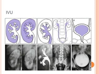 IVU
 