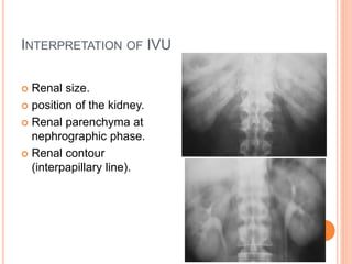 INTERPRETATION OF IVU
 Renal size.
 position of the kidney.
 Renal parenchyma at
nephrographic phase.
 Renal contour
(interpapillary line).
 