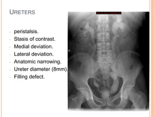 URETERS
- peristalsis.
- Stasis of contrast.
- Medial deviation.
- Lateral deviation.
- Anatomic narrowing.
- Ureter diameter (8mm).
- Filling defect.
 