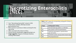 Nec Classification Radiology Conventional Radiography in Pediatric Gastrointestinal Imaging An ...