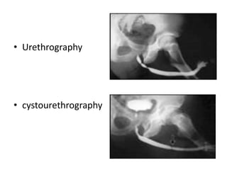 Cystourethrogram Technique Conventional Radiology In Urology.pptx