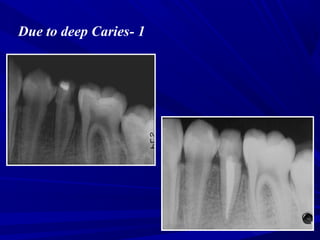 Conventional RCT | PPT