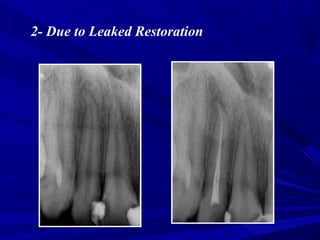 Conventional RCT | PPT