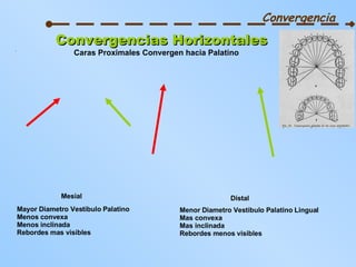 Convergencia Convergencias Horizontales Caras Proximales Convergen hacia Palatino Mesial Mayor Diametro Vestibulo Palatino Menos convexa Menos inclinada Rebordes mas visibles Menor Diametro Vestibulo Palatino Lingual Mas convexa Mas inclinada Rebordes menos visibles Distal 