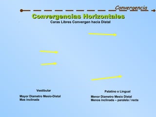 Convergencia Convergencias Horizontales Caras Libres Convergen hacia Distal Vestibular Mayor Diametro Mesio-Distal Mas inclinada Menor Diametro Mesio Distal Menos inclinada – paralela / recta Palatino o Lingual 