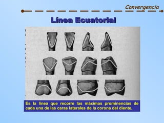 Línea Ecuatorial Es la línea que recorre las máximas prominencias de cada una de las caras laterales de la corona del diente. Convergencia 