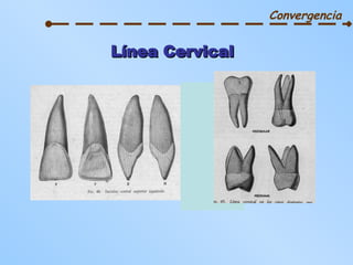 Línea Cervical Convergencia 