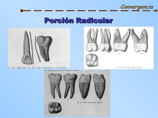 Porción Radicular Convergencia 